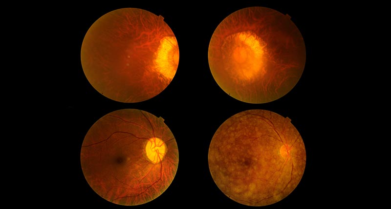 OCT adult pediatric eyecare local eye doctor near you.jpg